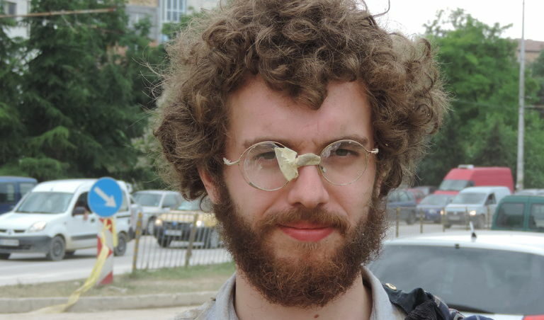 Очилата на Йоп са пострадали по време на работата му като доброволец в пострадалия от поройния дъжд миналия четвъртък варненски квартал "Аспарухово".