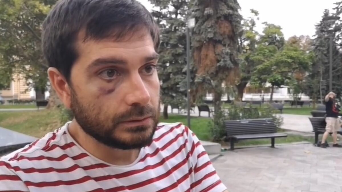 Кенаров, ден след побоя от страна на полицаите. Кенаров, ден след побоя от страна на полицаите.