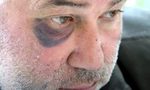 "Занимават се с побоища и рекет": какво премълчава МВР по случая с бития кмет на с. Белгун "Занимават се с побоища и рекет": какво премълчава МВР по случая с бития кмет на с. Белгун