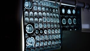 Как изкуственият интелект подпомага здравеопазването