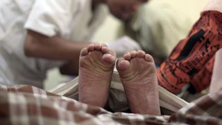 Евреи и мюсюлмани осъждат забрана на обрязването в Германия
