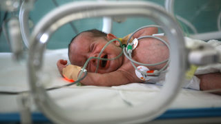 За пръв път в света жена с отстранена шийка на матката роди в Плевен