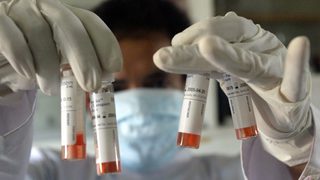 Учени разработват тест за урина, който да открива човешки папиломен вирус