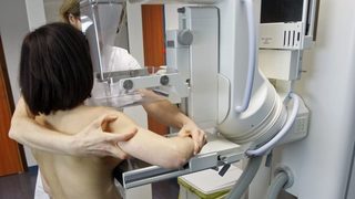 Смъртните случаи от <span class="highlight">рак</span> <span class="highlight">на</span> гърдата в Европа ще се удвоят до 2030 г., прогнозират учени