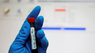 Руското спортно министерство отхвърли допинг обвиненията