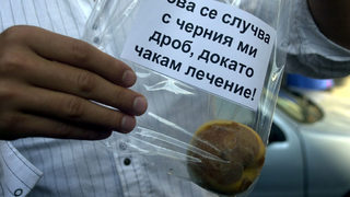Здравната каса няма да плаща лечението на пациенти с хепатит C с малки шансове за живот