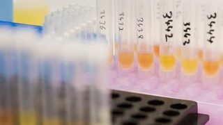 Шефът на еропейската атлетика е подменял допинг проби през 80-те години