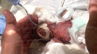 Роденото с най-ниско тегло момче на света беше изписано от болница в Япония