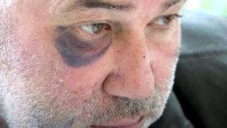 Прокуратурата прекрати разследването за побоя над кмета на село Белгун