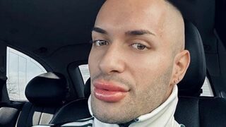 Щангист твърди, че е бил нападнат заради провокативния си външен вид