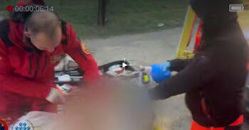 Лекар спаси унгарец като заши сърцето му на улицата