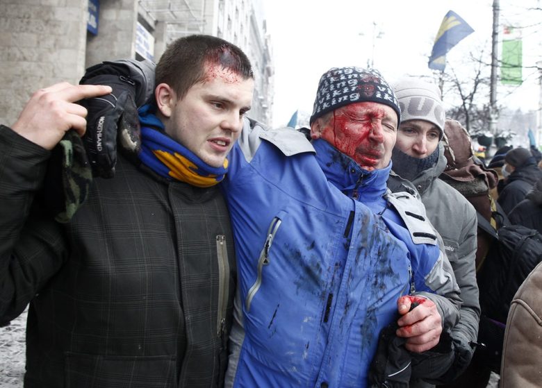 Протестиращите обвиняват полицията, че нарочно ги обстрелва с гумени куршуми в главите и се цели в медиците на бойното поле. 50% от пациентите в полевите болници са с рани в лицето и главата, отбелязва "Ройтерс".